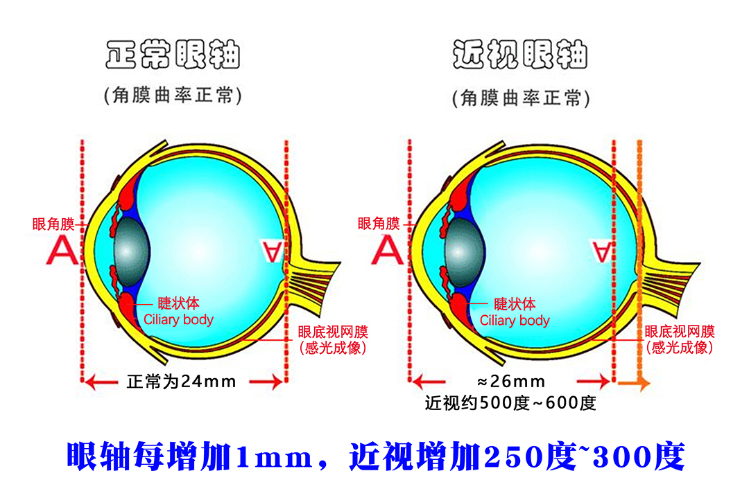 26mm眼轴.jpg